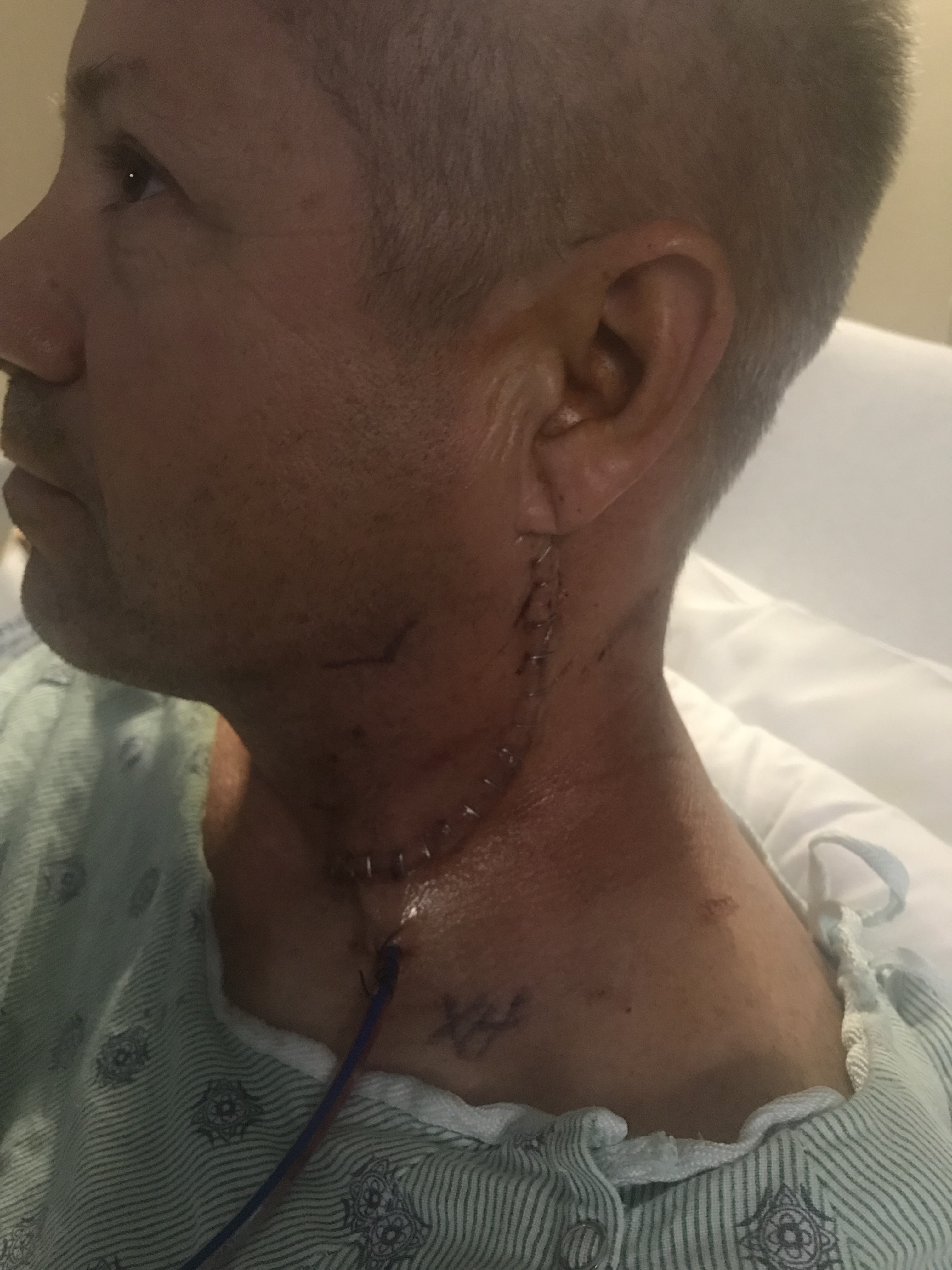 YxQ8q4kEQl6i5E83MHtbsw